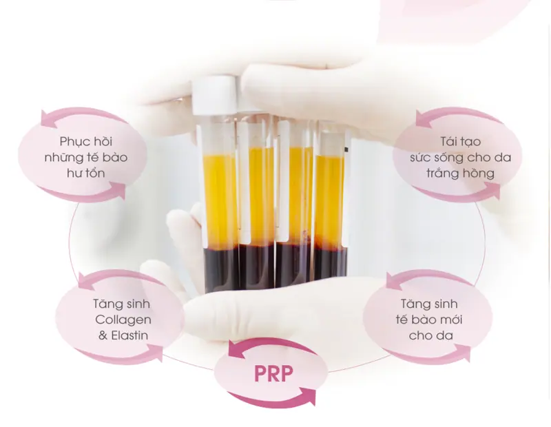 PRP công nghệ đột phá mới giúp làm trẻ hóa da